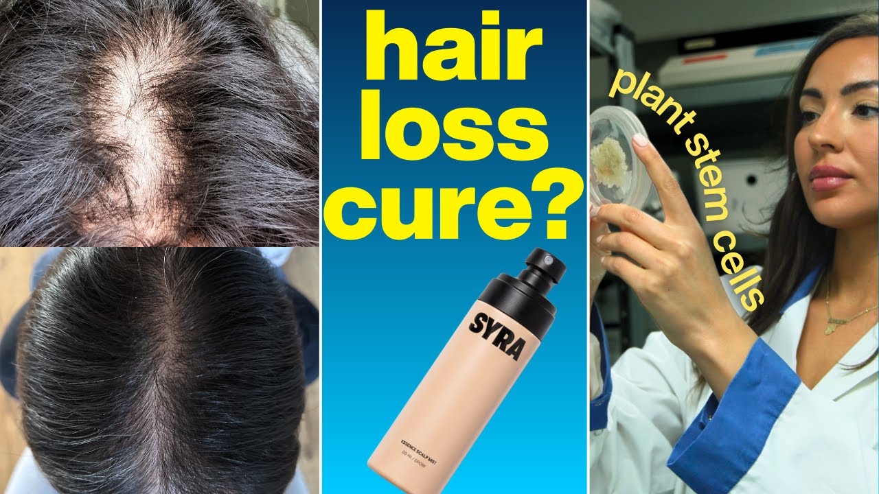 How I made my own hair loss and hair growth spray that ACTUALLY works