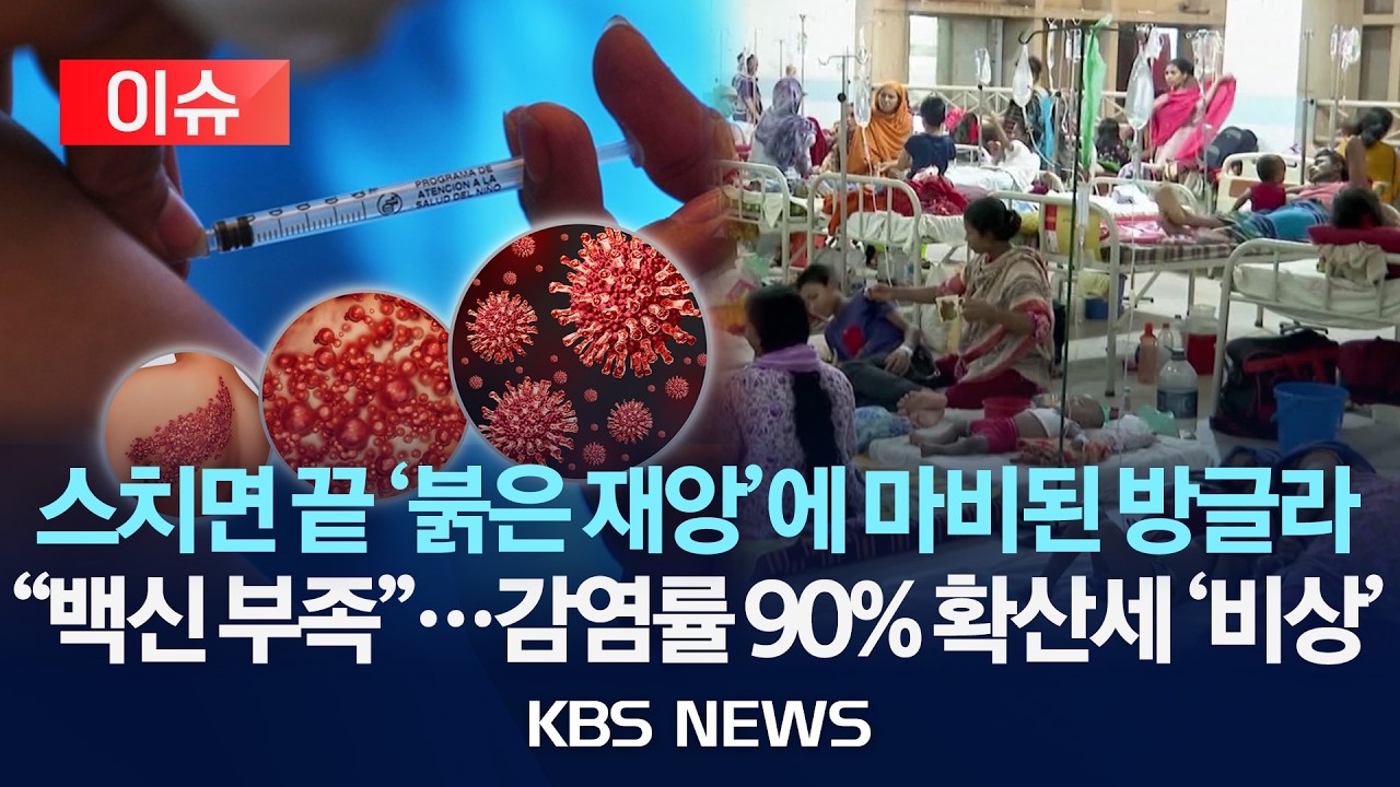 [이슈] 스치면 당하는 '붉은 재앙' 방글라 잠식...백신 역부족...감염률 90% 확산세 '비상'/2026년 4월 7일(화)/KBS
