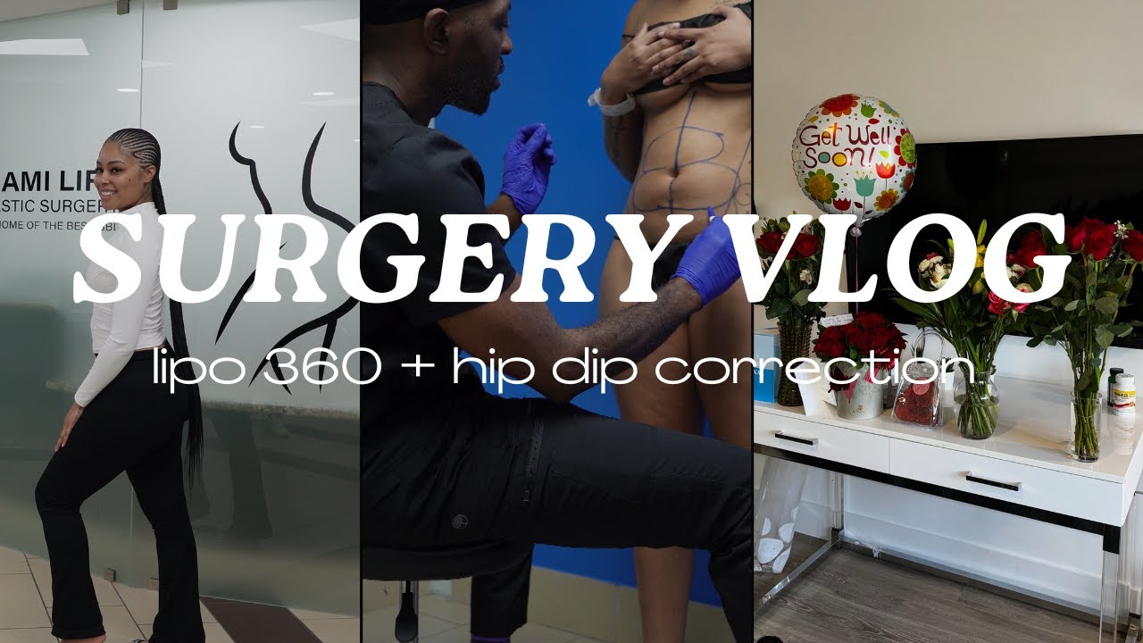 SURGERY VLOG | ROUND 2 LIPO 360 + HIP DIP FAT TRANSFER W/ DR. O AT MIAMI LIFE PLASTIC SURGERY