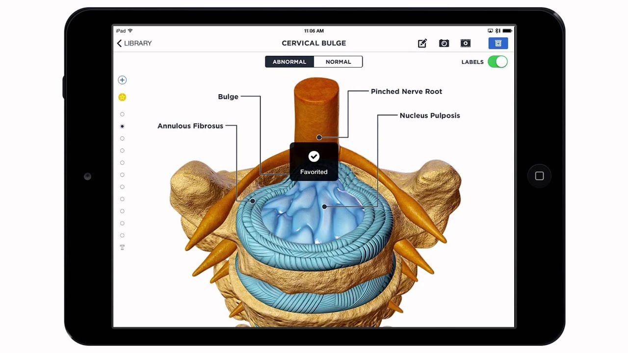 How to Use the 'Favorite' Feature in Patient Education Apps by Orca Health