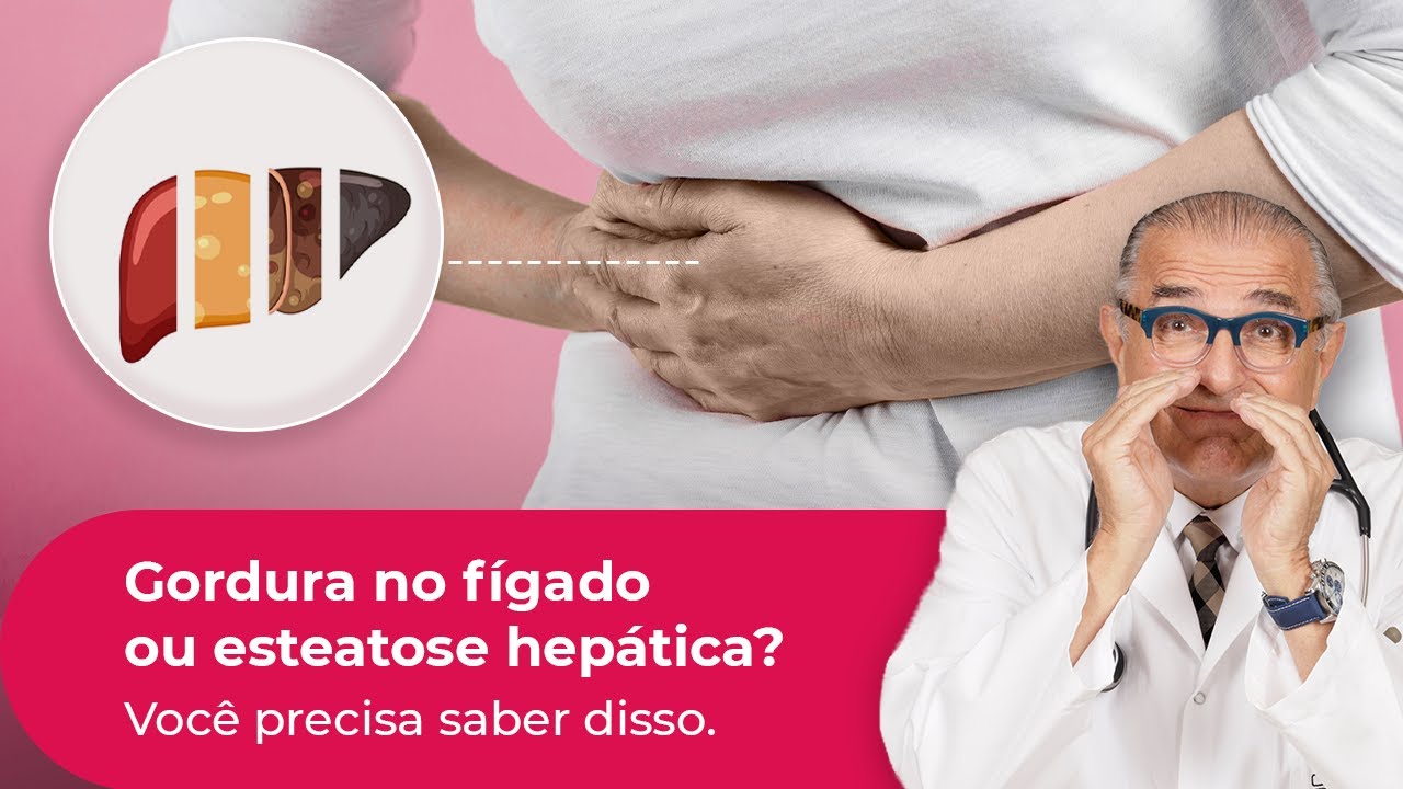 GORDURA NO FÍGADO OU ESTEATOSE HEPÁTICA: o que você precisa saber