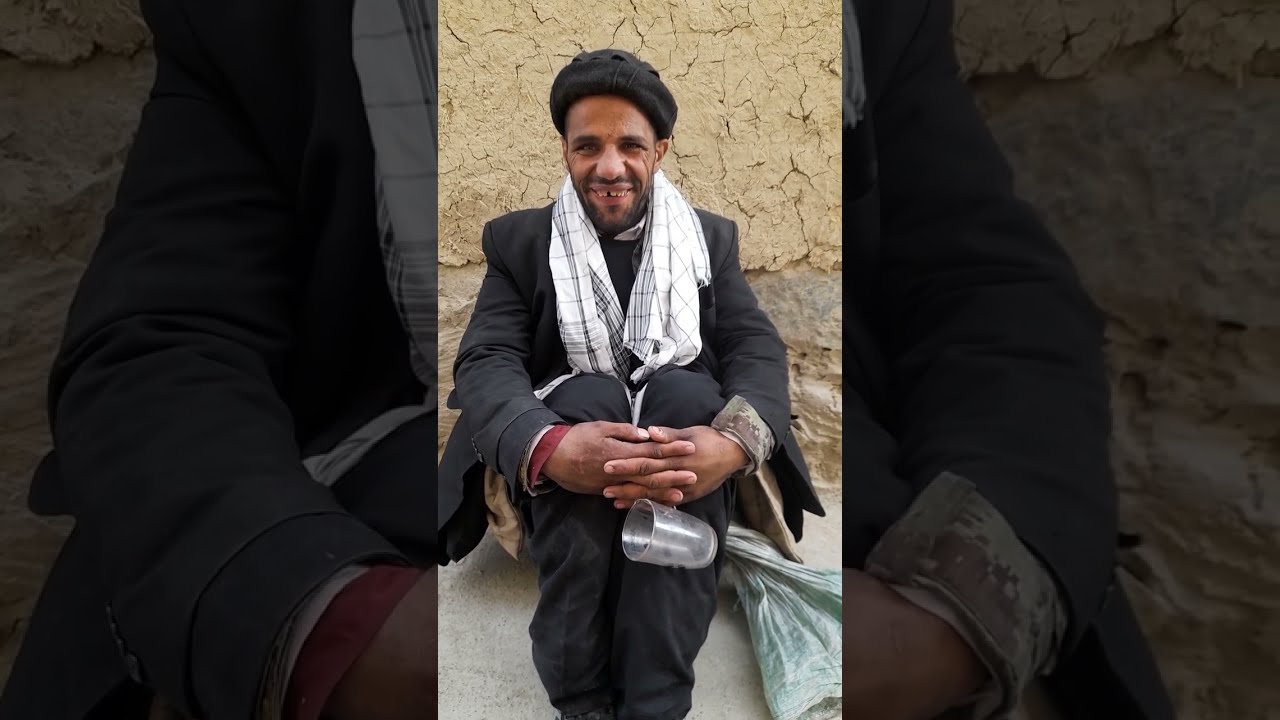 اشرف ملنگ چهلستون که با حادثه ترافیکی مشکل عصبی پیدا کرده بود صحت مند گردید
