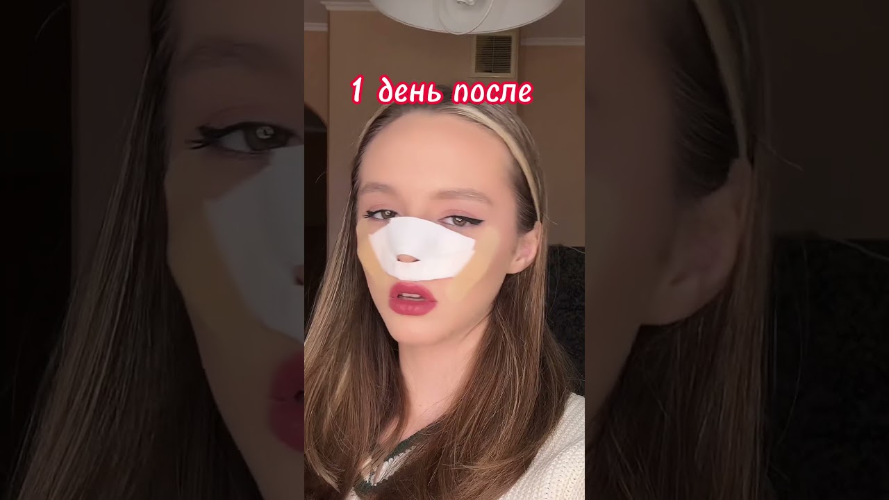Я решила сделать пластическую операцию