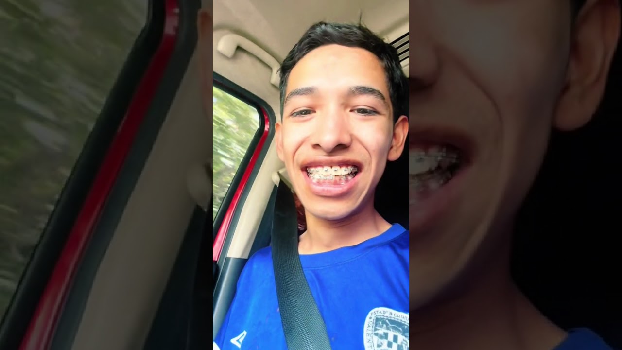 El hígado encebollado 