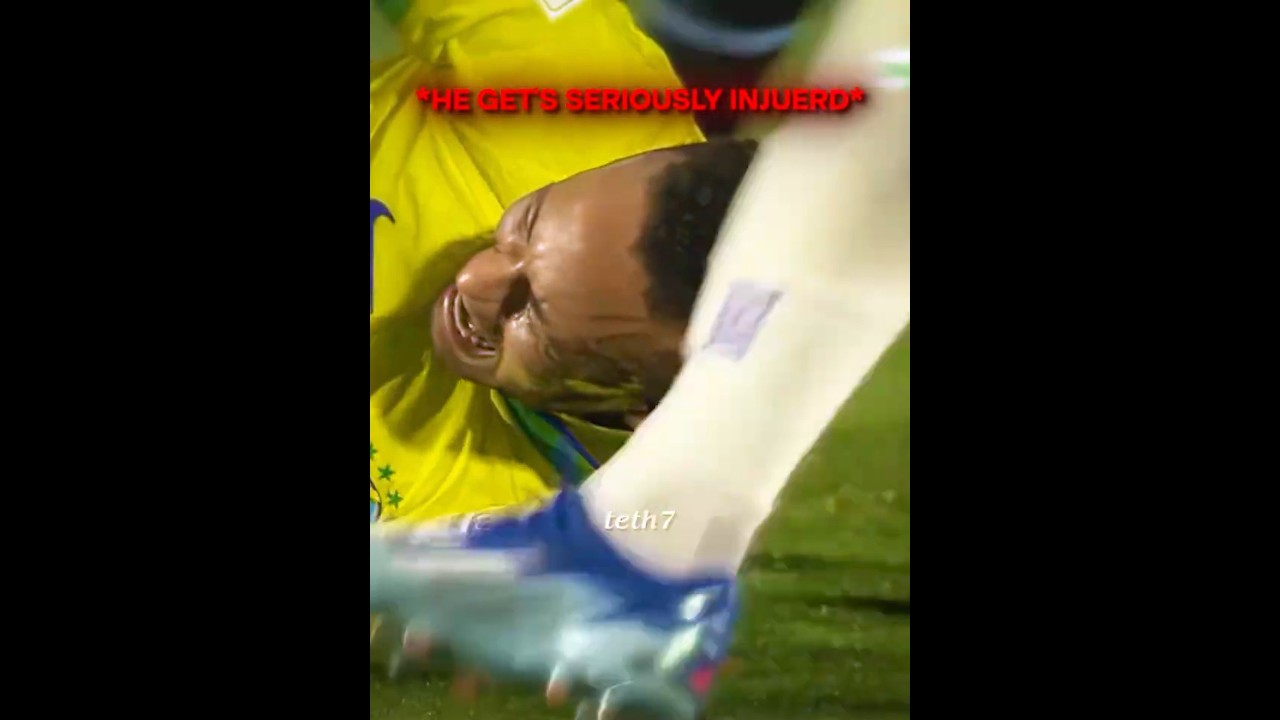 Przerażające kontuzje piłkarskie 💔