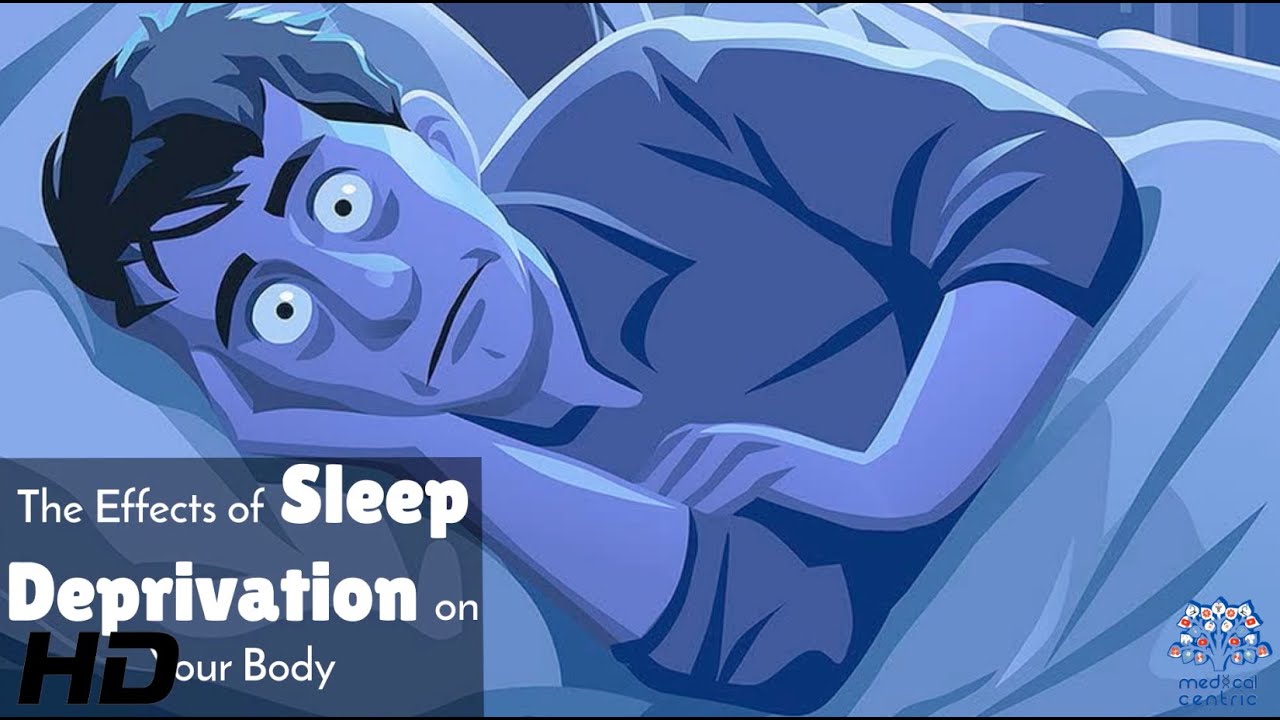 The Scary Truth About Sleep Deprivation!