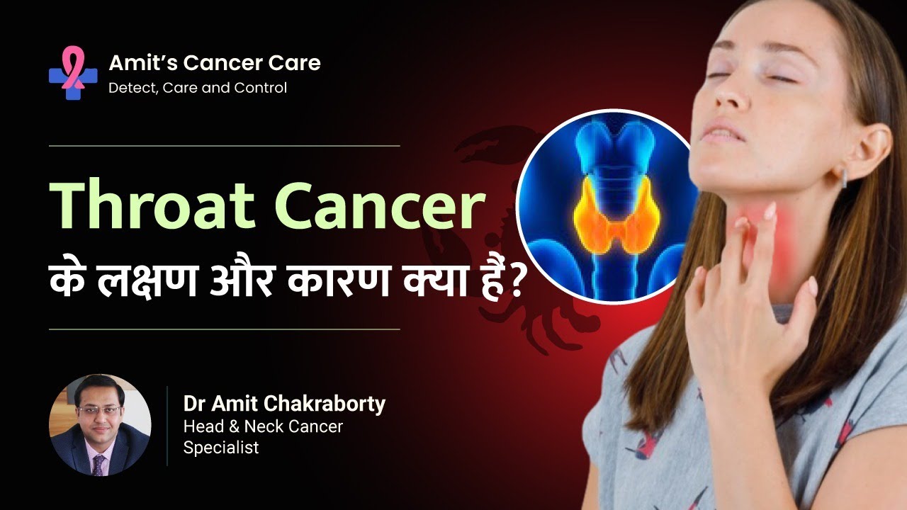 Signs & Causes of Throat Cancer | Throat Cancer के लक्षण और कारण | Dr. Amit Chakraborty