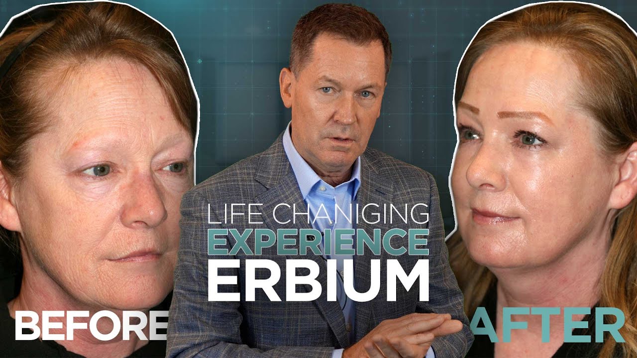 No Scalpels, No Facelift: See How Erbium Laser Restores Youthful Skin