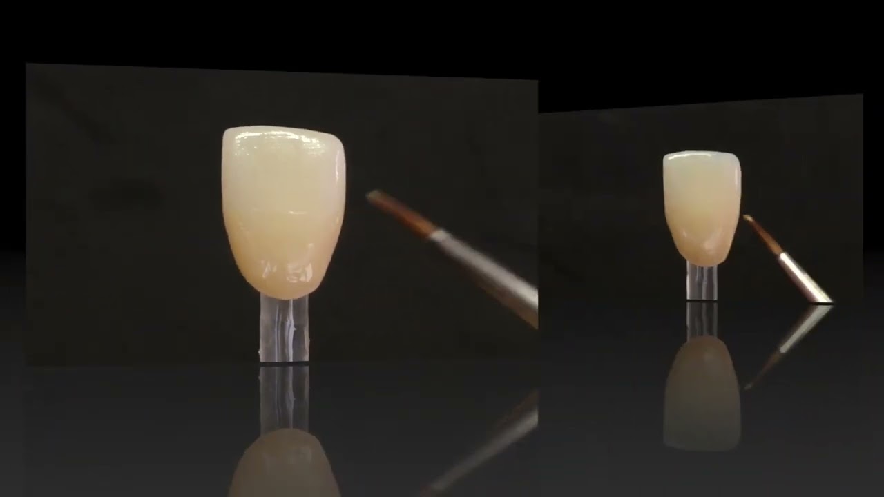 Finitura corona anteriore full contour con CZR FC Paste Stain