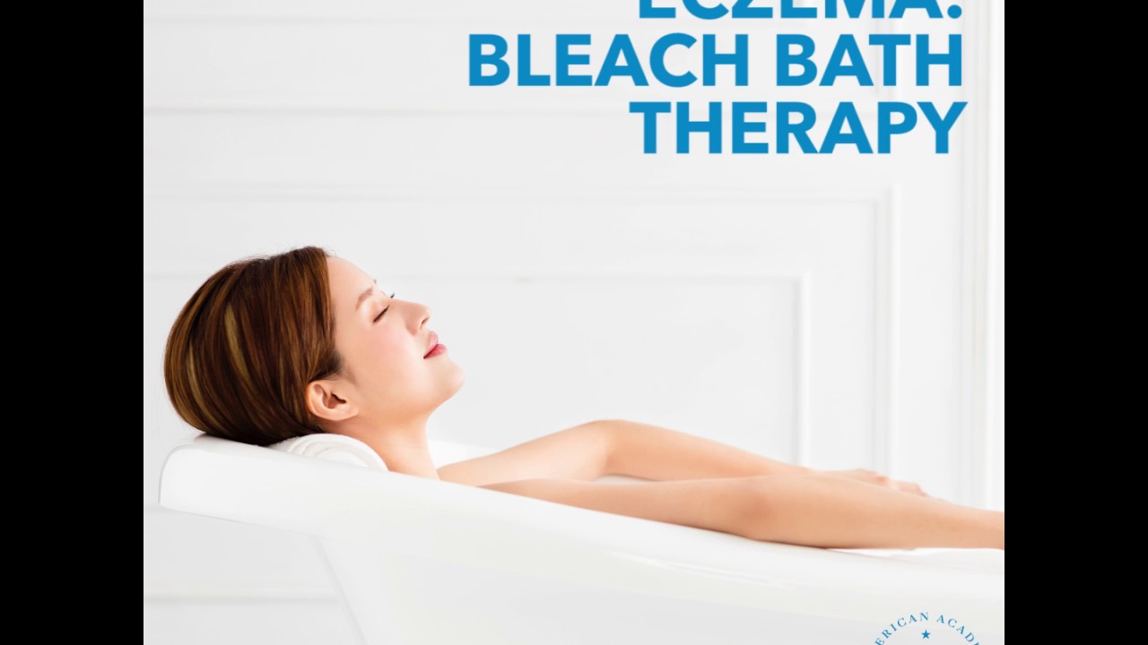 How to use bleach baths to help manage eczema flares