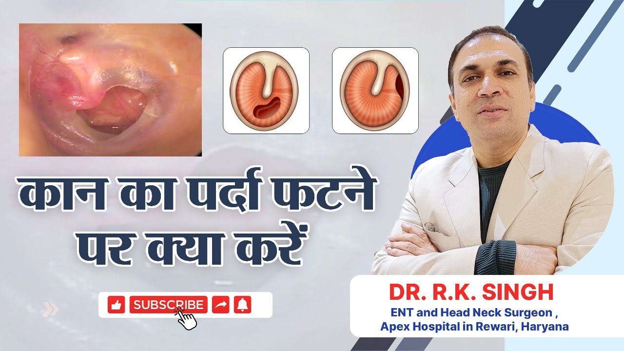 कान का पर्दा फट जाए तो क्या करें? | Dr. R.K. Singh #earhealth  #hospitality #ent