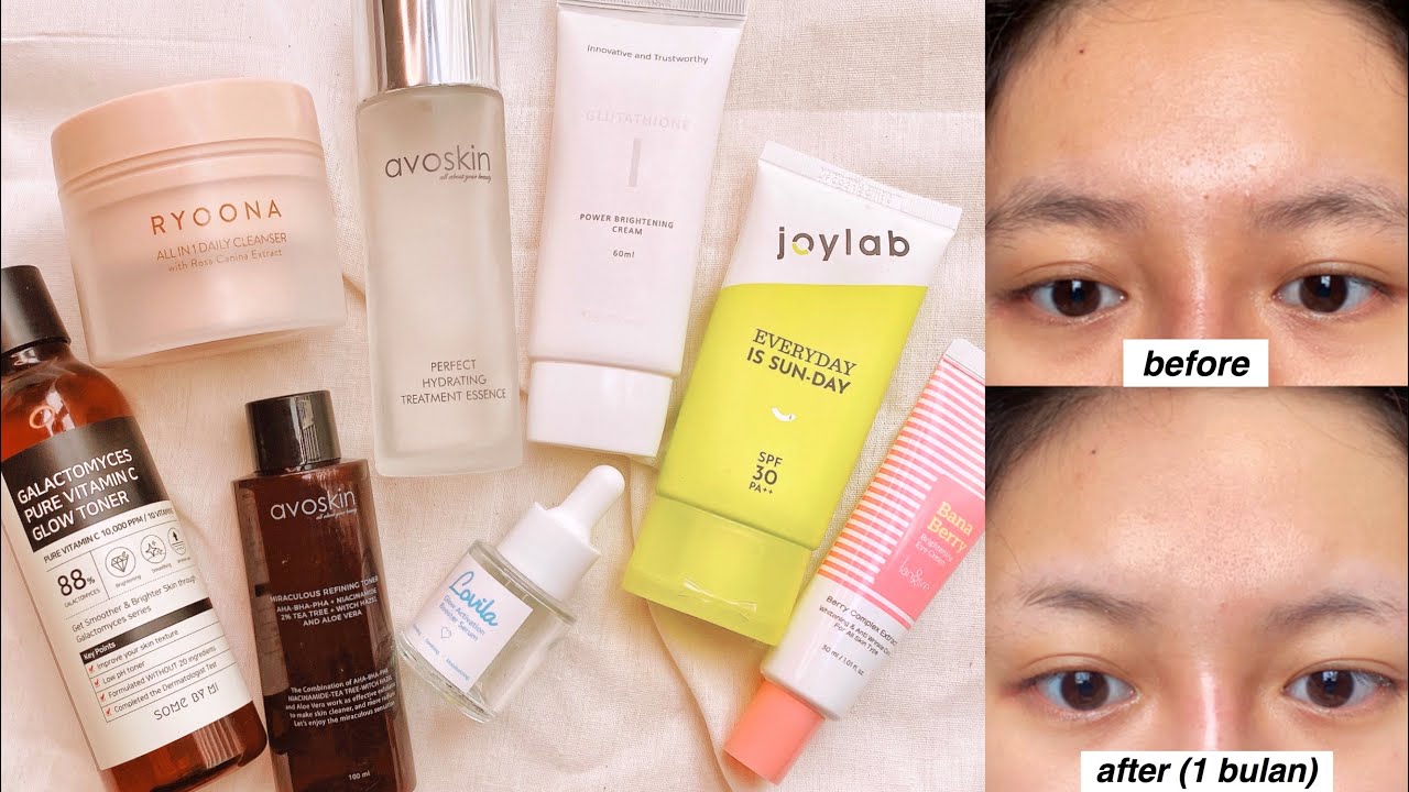 Skincare Kulit Kusam & Belang | review skincare routine bulan maret ☘️