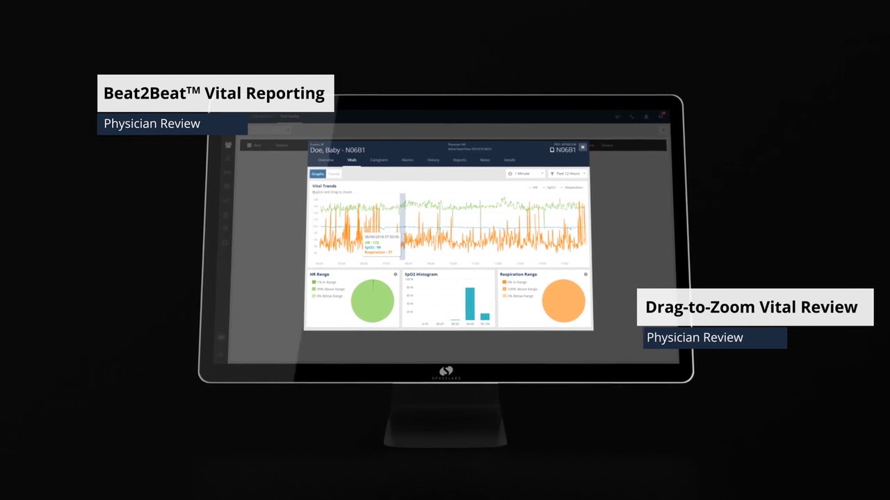 Connect, communicate, track, and report on all patient monitoring