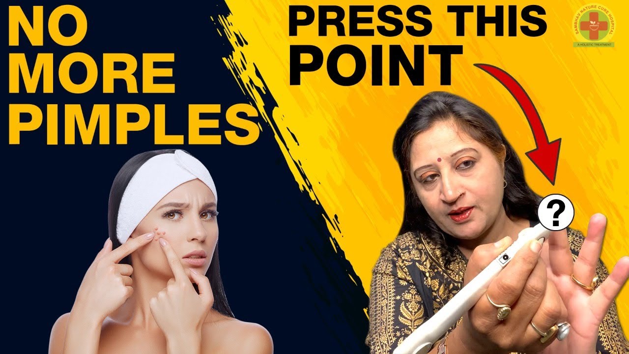 Acupressure Points For Pimples - Acupressure For Acne and Pimple || Sujok Therapy For Pimples