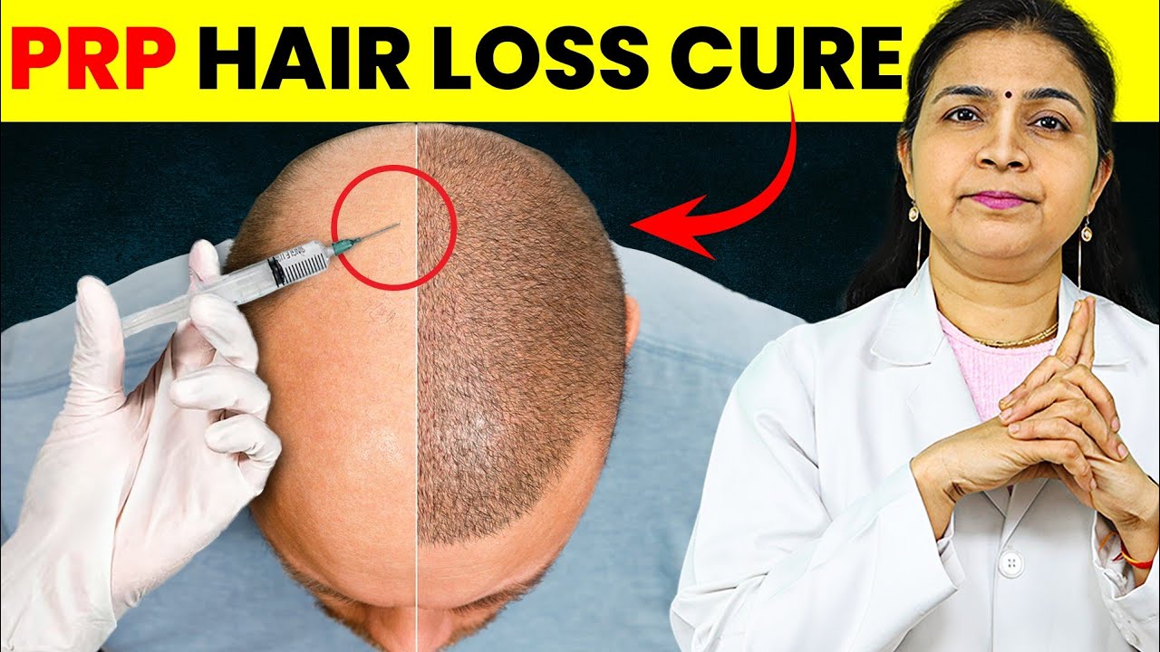 PRP Magic: Hair Loss Treatment Before and After 2024 | PRP Hair Treatment | PRP for Hair Loss