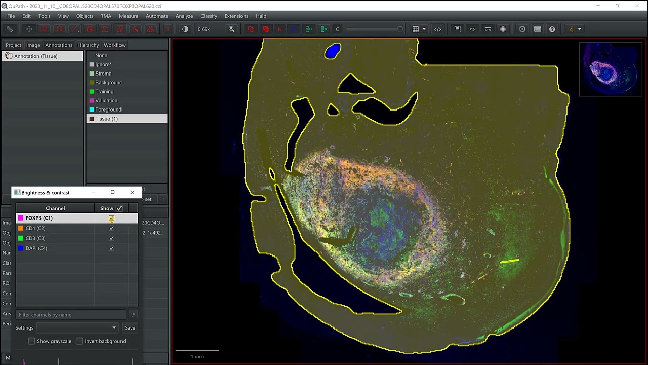 Tissue and nuclei segmentations
