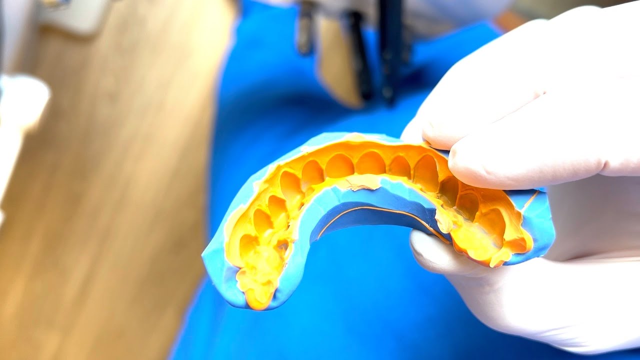 Изготовление матрицы из шпатлевки