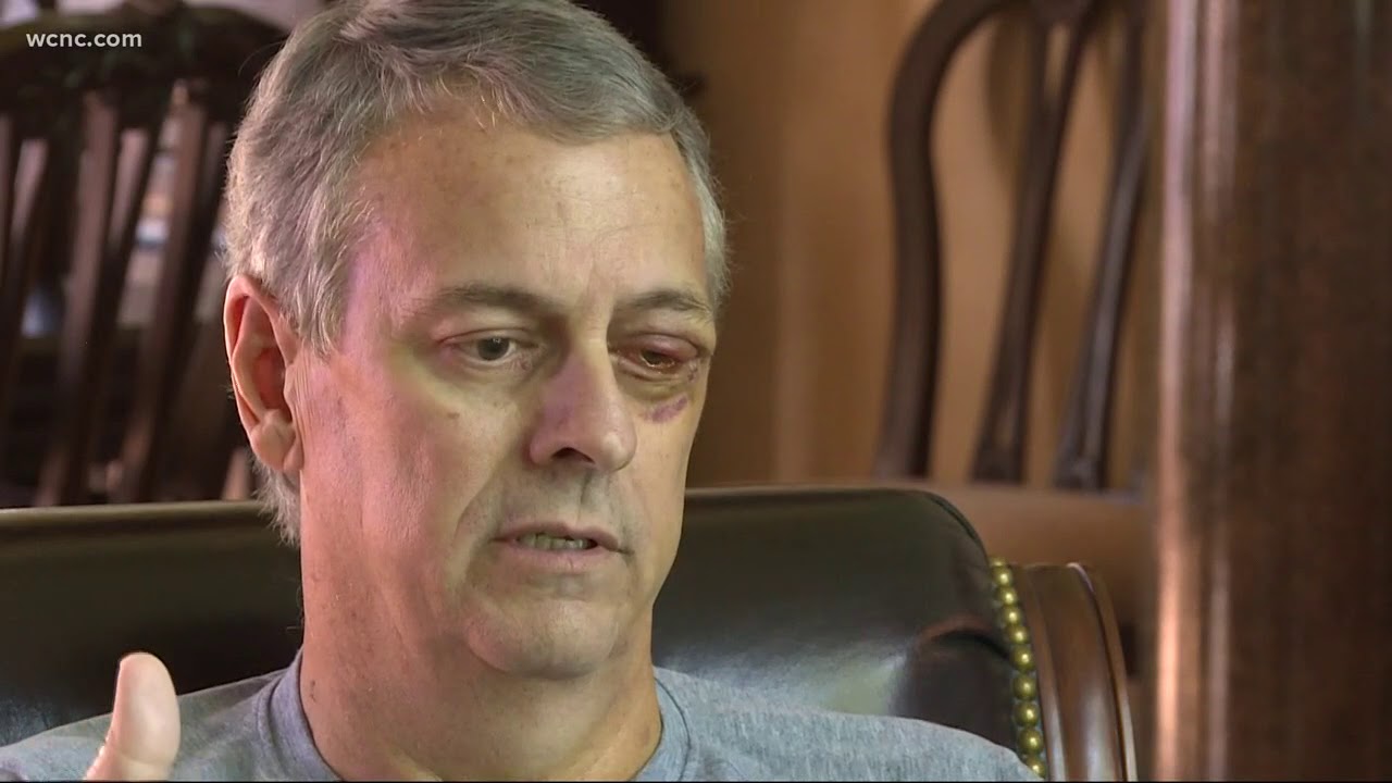 Man hurt in jet ski explosion on Lake Norman speaks out