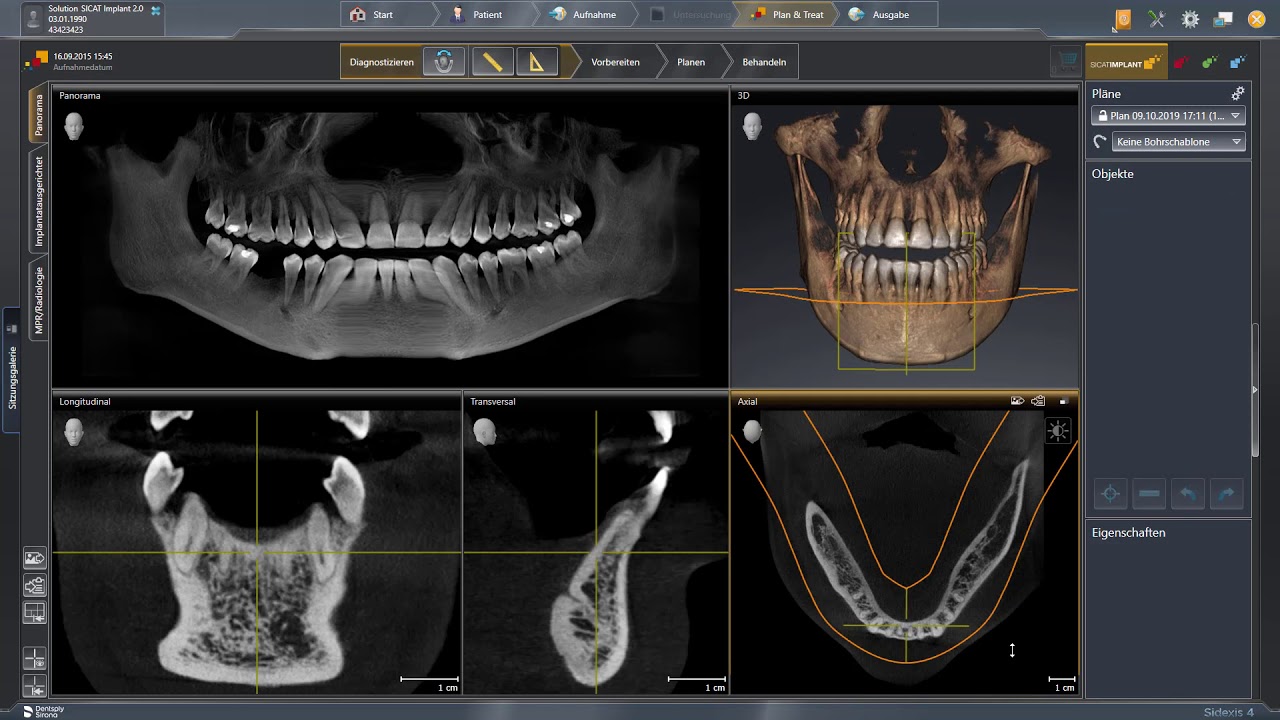 SICAT Implant 2.0 - Adjusting Panoramic Region & Measurements