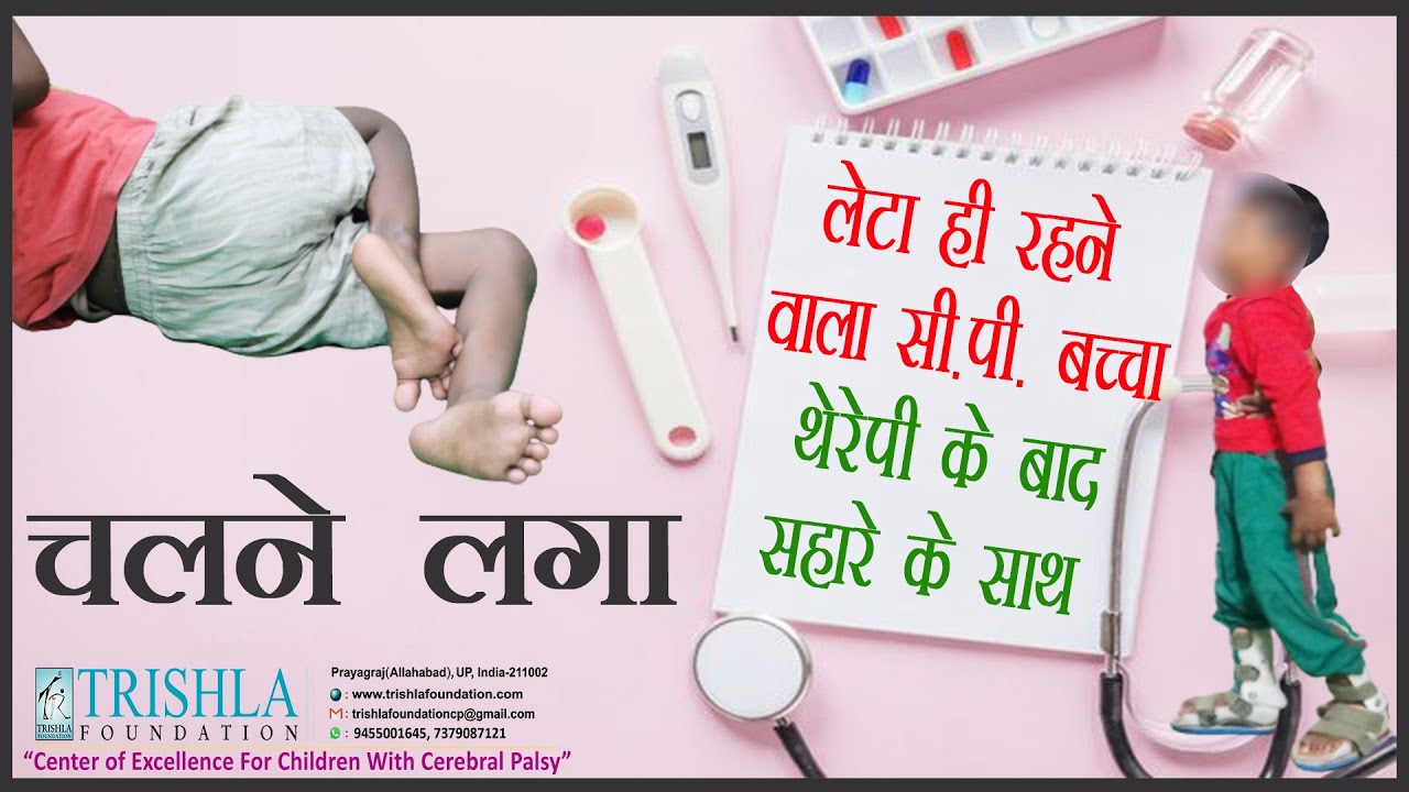 CP Success Story: Dystonic Cerebral Palsy Kid's Unbelievable Outcome with Physiotherapy | Trishla