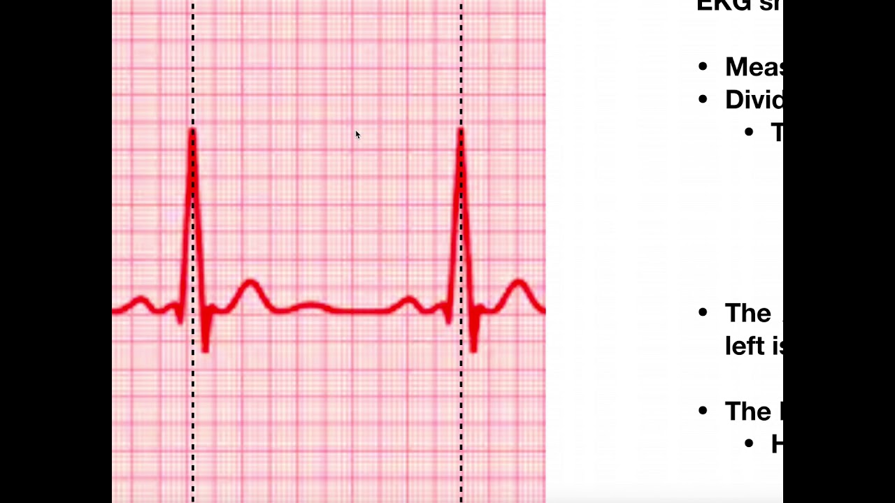Calculating Heart Rate [HR] from an Electrokardiogram [EKG]