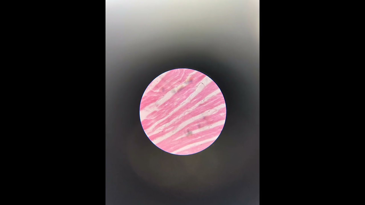 Plus two Zoology practical exam muscle tissue identification #zoology