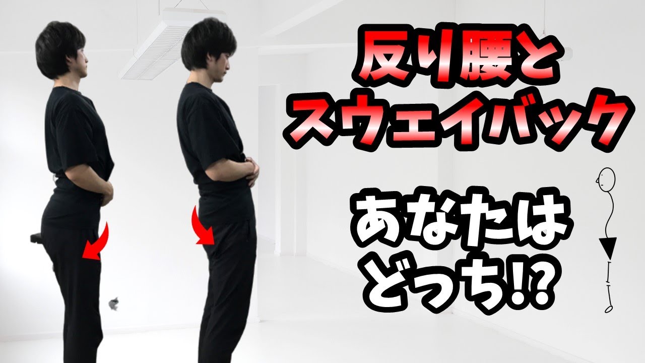 反り腰と思いきや…スウェイバックかも！？やるべきストレッチが違います！