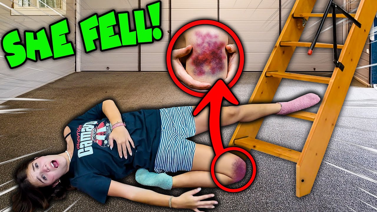 Carlie Fell And Hurt Her Knee!