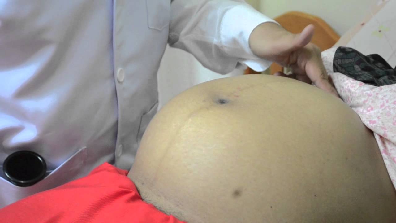 Abdominal Examination For Obstetric Patient Group 1 CUCMS