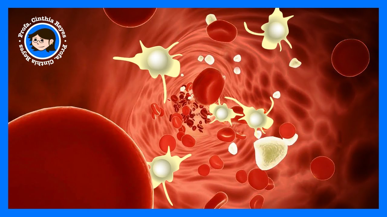HEMOFILIA 💉, Origen y Tratamiento (¿TERAPIA GÉNICA🧬 = vacunas?)