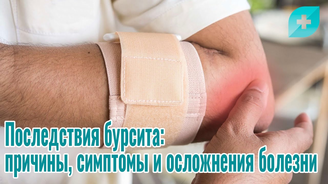 Последствия бурсита: причины, симптомы и осложнения болезни