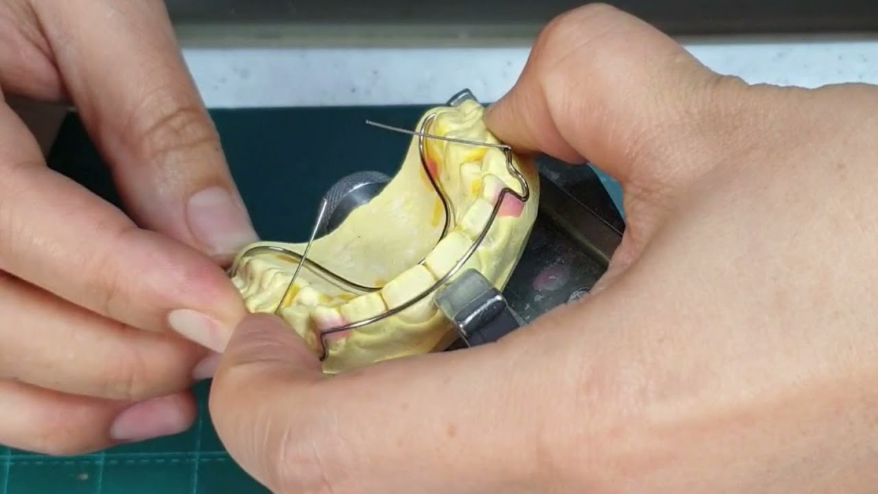 How to make a wraparound retainer auxiliary wire /보조와이어