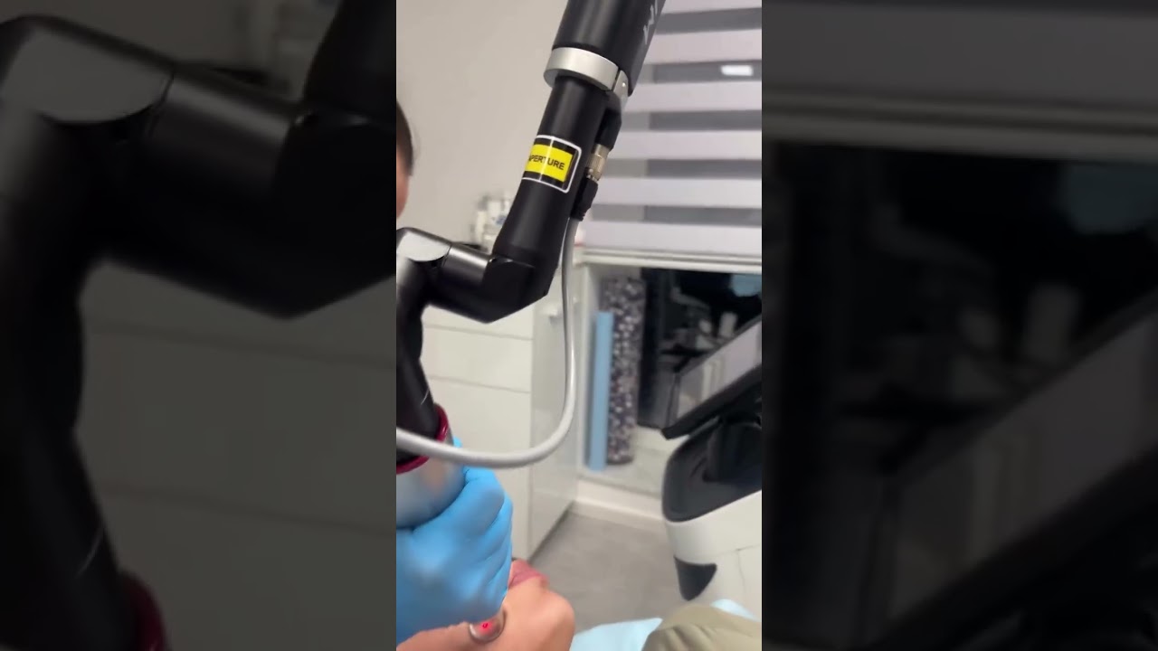 PICO lasersko podmlađivanje kože bez oporavka | Rejuva Beograd