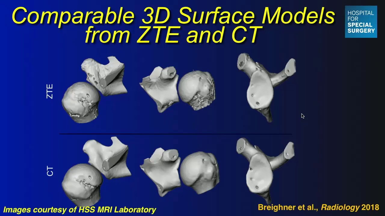 ISMRM MR Academy - Rapid MR (3D, CS, Machine Learning)