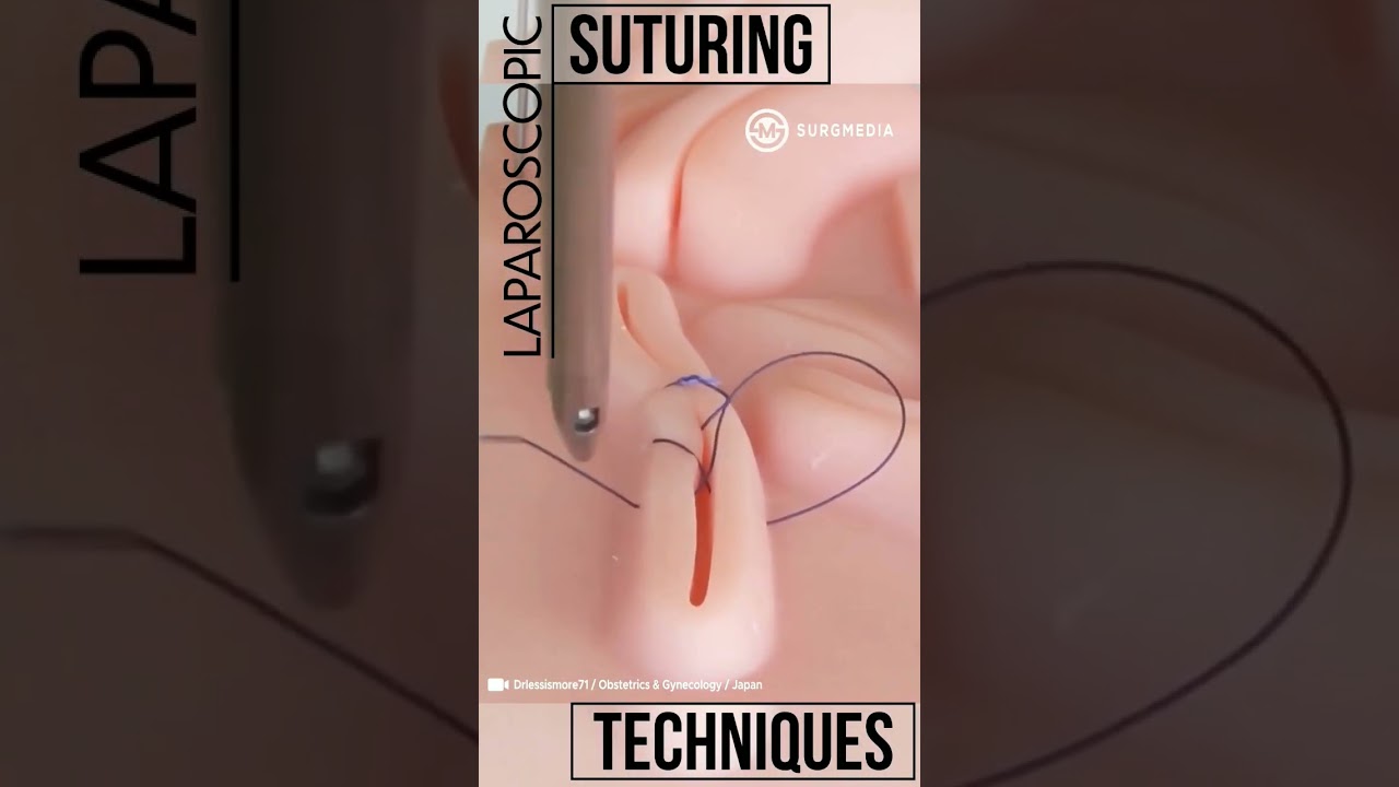Laparoscopic Suturing Techniques #shorts #tech #suture #training #laparoscopy #medical #medicine