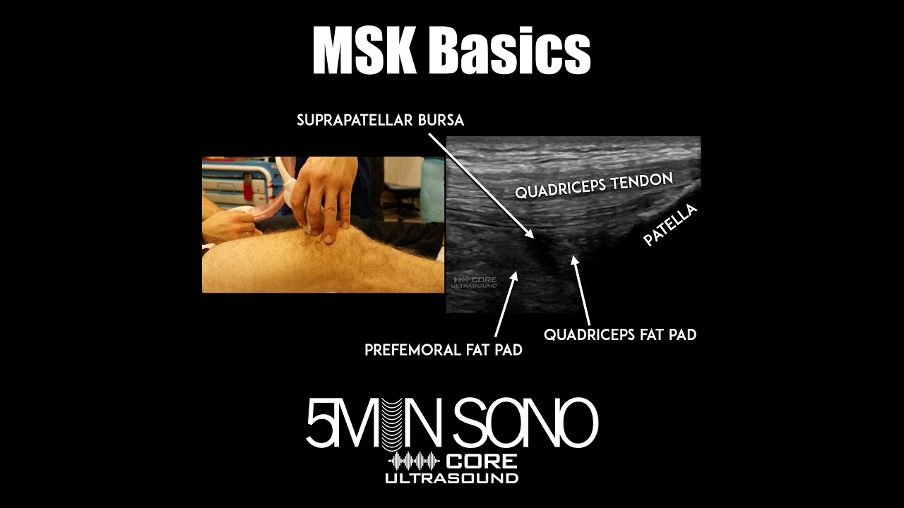 5 Minute Sono - MSK Basics
