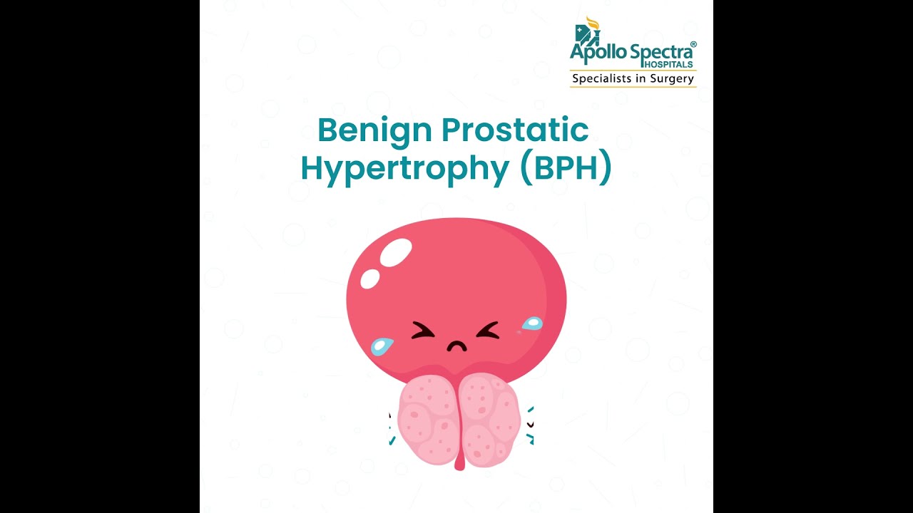 What is Benign Prostatic Hypertrophy (BPH) and how do we treat it?