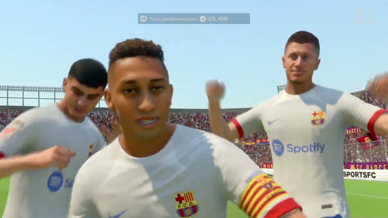 Lewy show