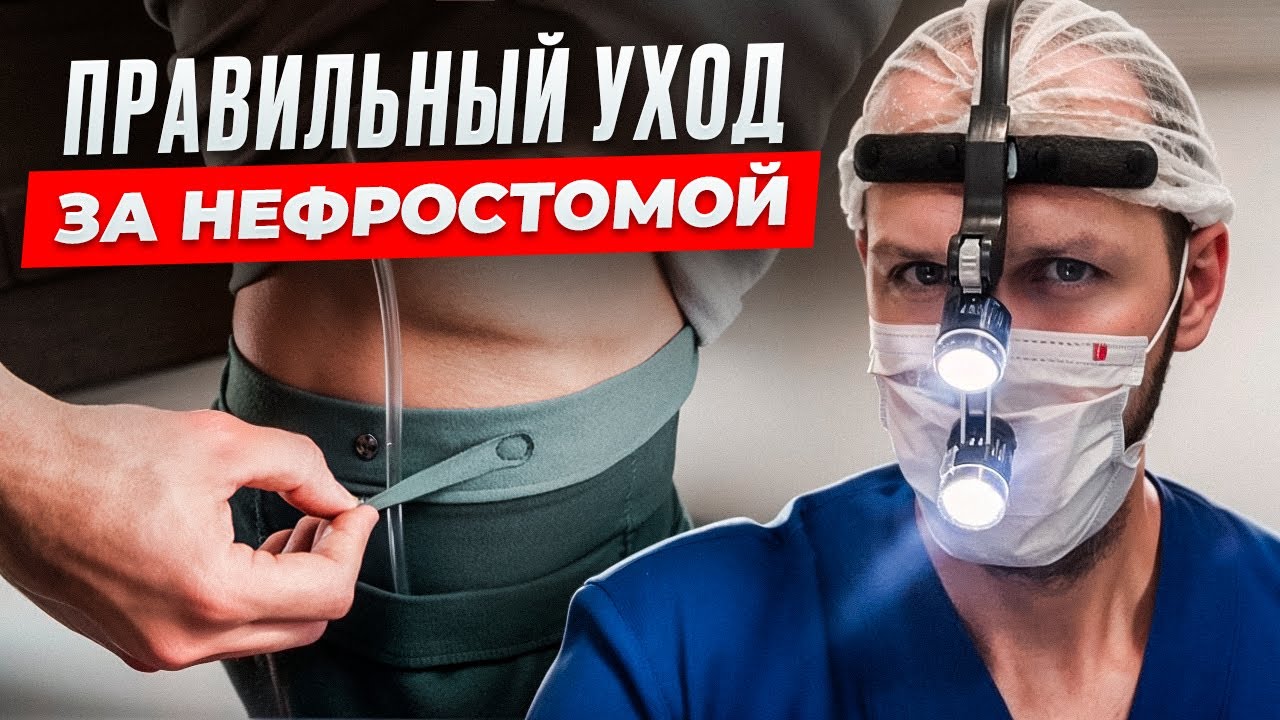 Нефростома. Уход и подход к катетеру. Почки. Перевязка‼️#нефростома #катетер #доктор