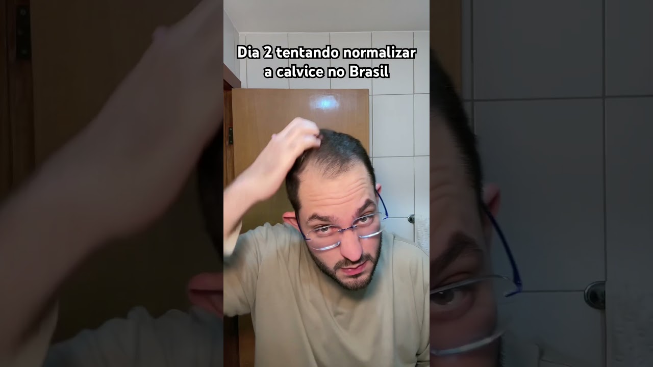 Dia 2 tentando normalizar a calvice no Brasil #calvo #calvice #cabelo #cabelos #hair
