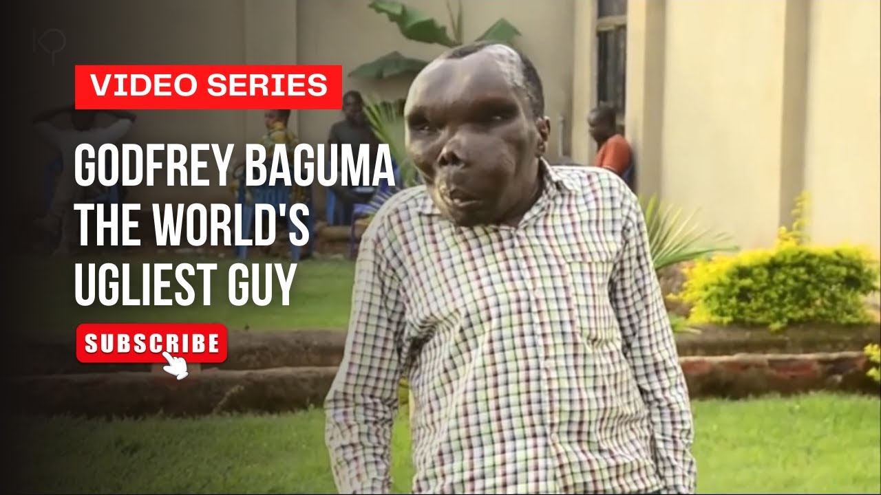 Godfrey Baguma : World's Ugliest Guy