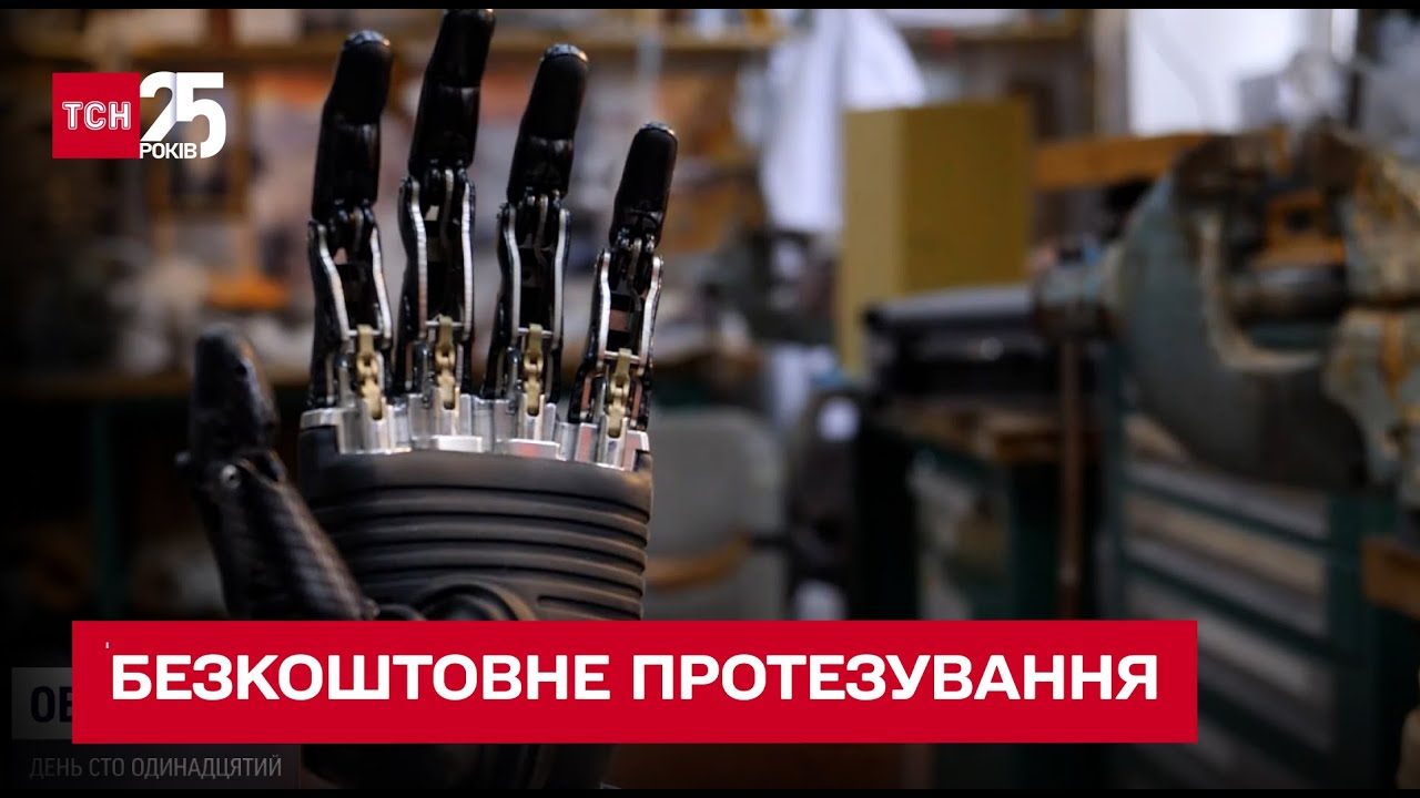 🦿 Не нужно собирать деньги на протезы бойцам – правительство обещает помощь после ампутации