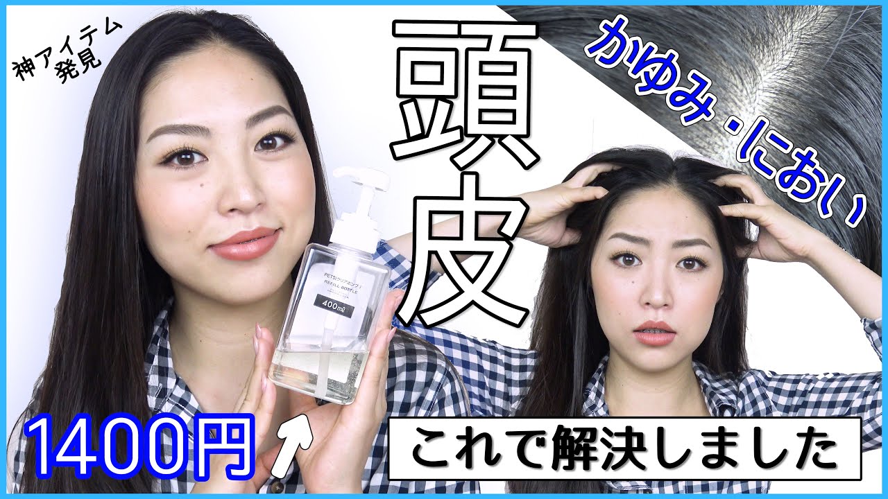 【神】頭皮のかゆみ・においを解決してくれたアイテムはこちらです🤫🙏