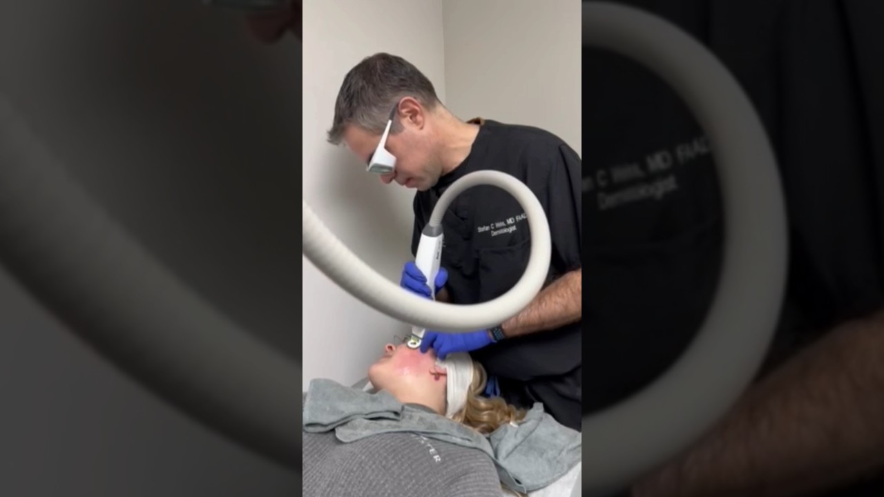 AviClear - FDA cleared Laser Treatment | Mild moderate-severe Acne Laser Treatment Procedure #shorts