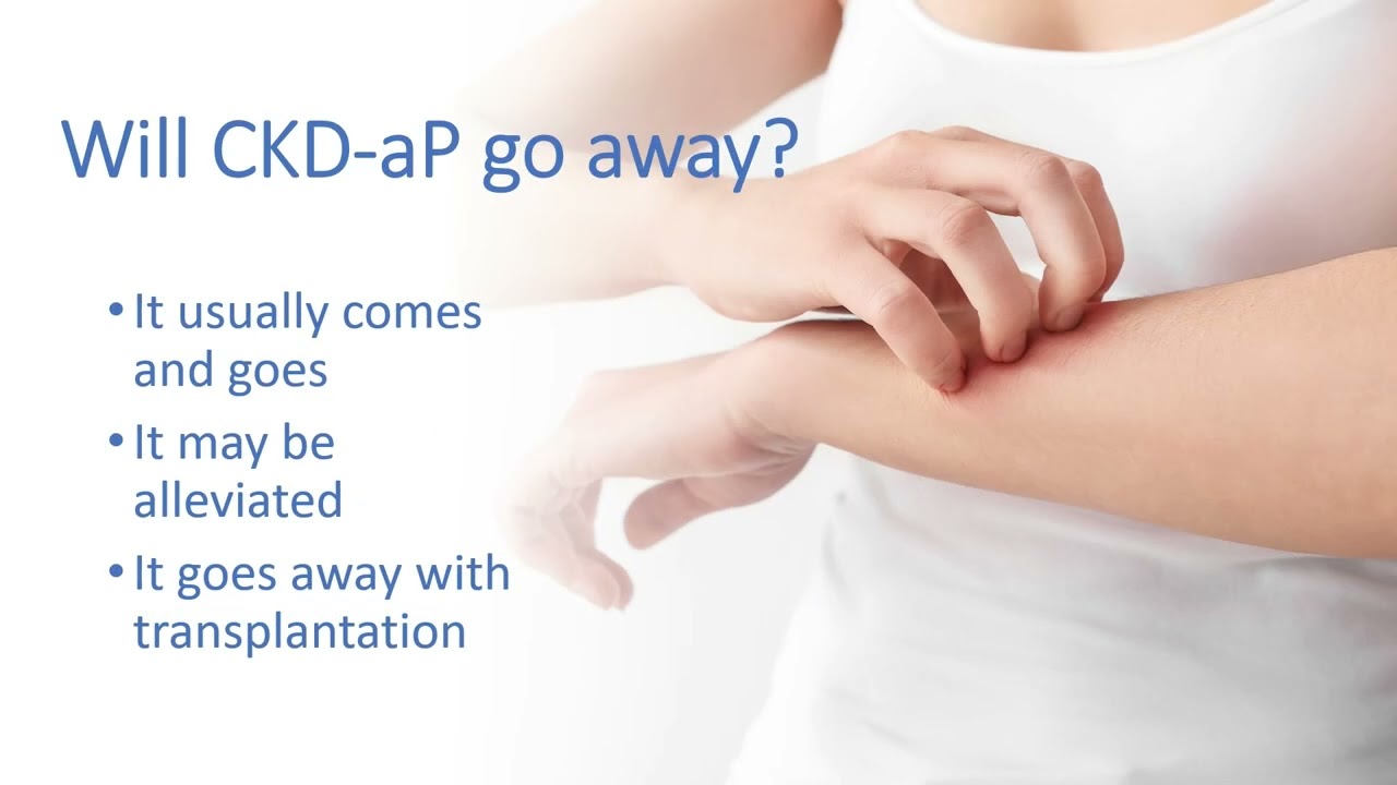 Stop the Itch: Understanding Chronic Kidney Disease-Associated Pruritus (CKD-aP)
