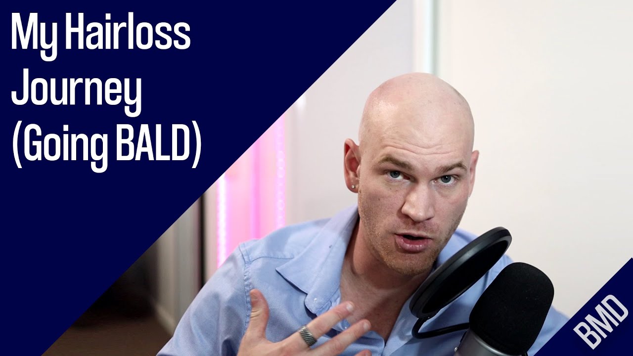 My Hairloss Journey (Going BALD)