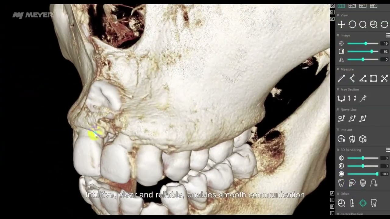 MyDent Viewer - 3D Orientation