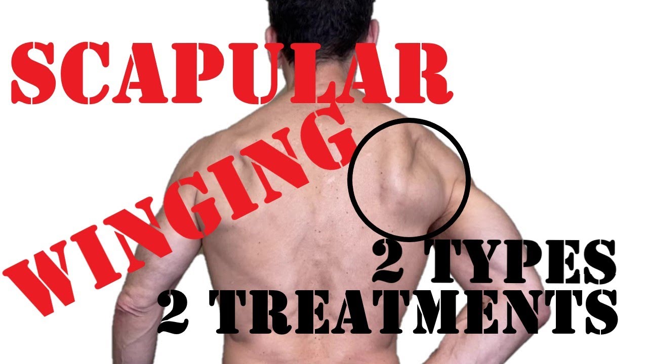 How to Fix Scapular Winging (and Why it Happens)