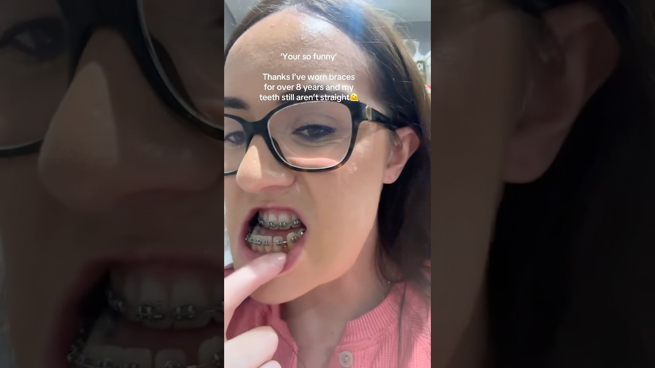 This Is What Needing JAW SURGERY Looks Like! 😭🦷
