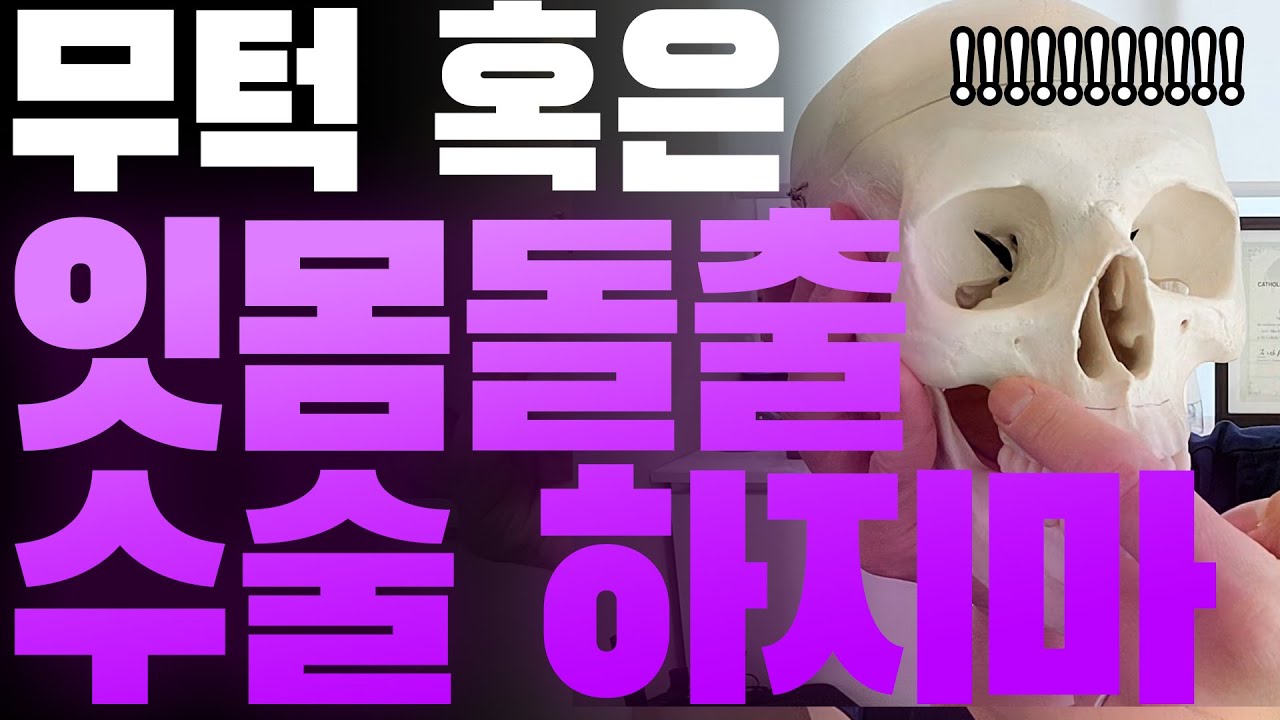 😩잇몸돌출수술😩ASO수술해서 예쁘다고 느낀 적 없음...^^;;;;